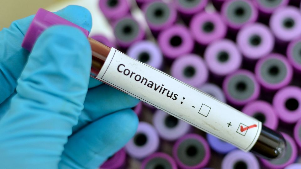 Число умерших из-за коронавируса в мире превысило 5 млн